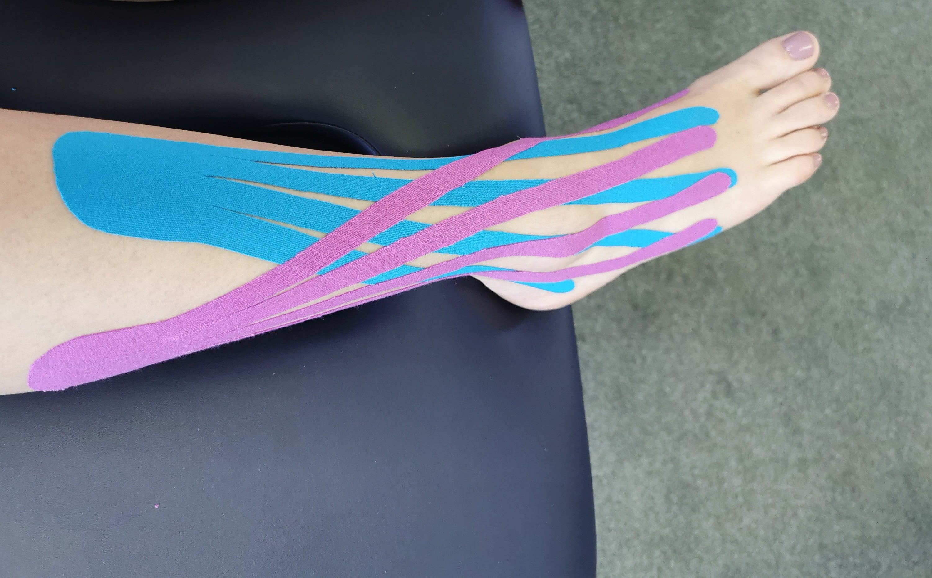 Kineseology Taping to the Ankle for an ankle sprain