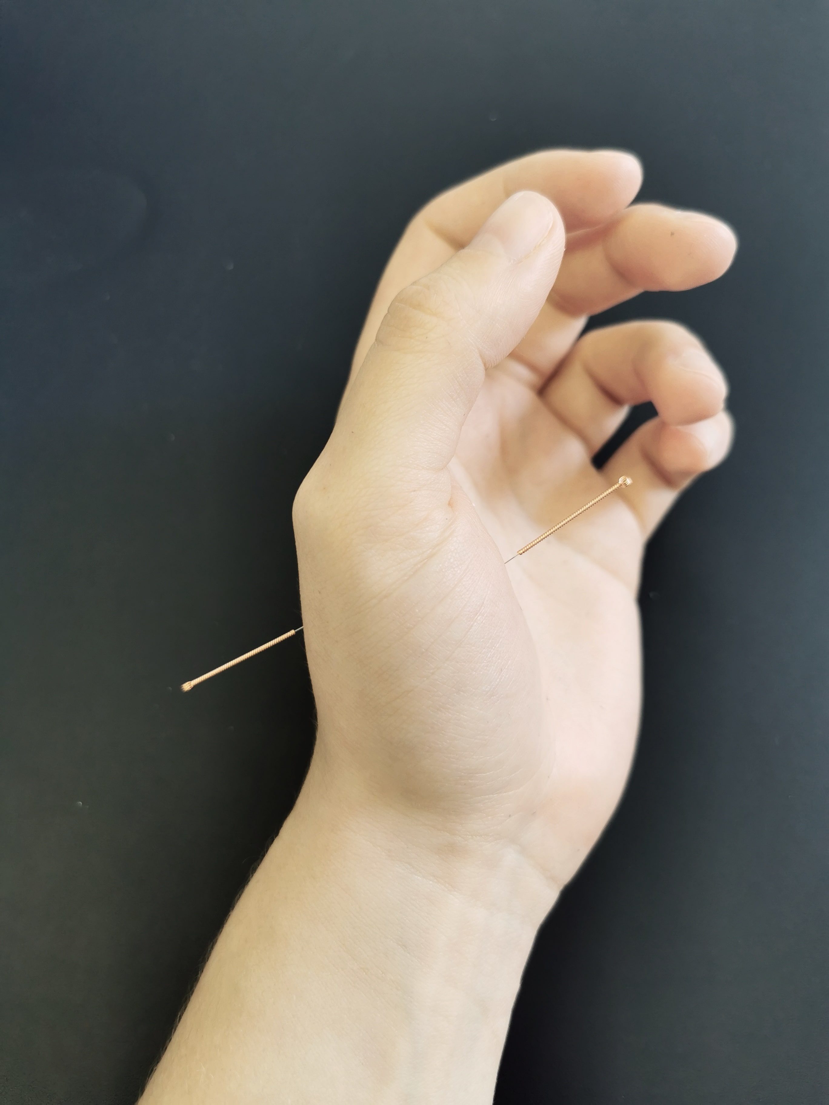 Image of Dry Needling in a hand